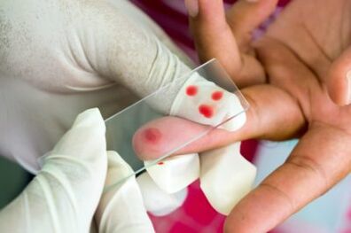 Diagnostika bolesti v kĺboch prstov
