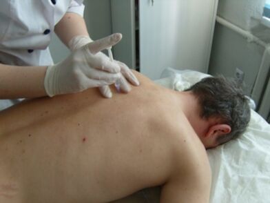 Intraartikulárne injekcie chondroprotektorov na hrudnú osteochondrózu