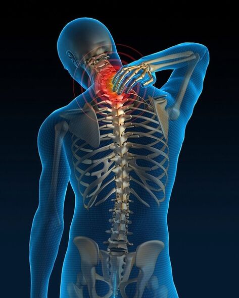V počiatočnom štádiu liečby cervikálnej osteochondrózy sa bolesť v krku zvyšuje